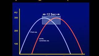 Evaluation of Chest Pain: the Triple Rule Out Part 2