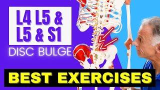 L4 L5 & L5 S1 Disc Bulge, Best Exercises Rehab For Relief