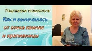 Как я вылечилась от отека квинке и крапивницы.Часть 1