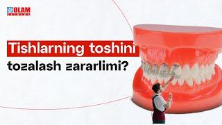 Tishlarning toshlarini tozalash zararlimi? | Olam klinika