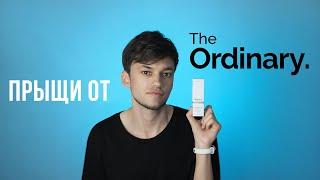 ПРЫЩИ ОТ НИАЦИНАМИДА THE ORDINARY | ОБСЫПАЛО ОТ КОСМЕТИКИ — ЧТО ДЕЛАТЬ?