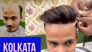 Hair patch in Kolkata. Hair wig in Kolkata. Hair wig for men. Hair patch for men.#hairreplacement