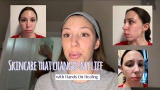 Skincare that transformed my skin