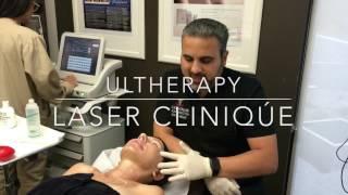 Ultherapy performed by Dr. P. Alexander Ataii