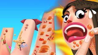 Acne Runner - MAX LEVEL Funny Gameplay Androi, ios