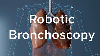 Lung Biopsy Via Robotic Bronchoscopy - Yale Medicine Explains