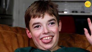 A Teenager with a Smooth Brain (Lissencephaly)