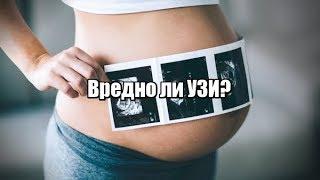 Вредно ли УЗИ при беременности, как часто можно делать УЗИ?