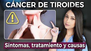 THYROID CANCER: Symptoms and treatment‍️ @DraPauZuniga