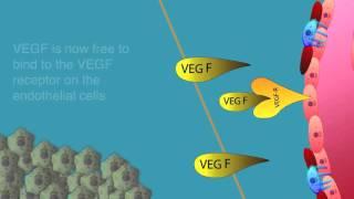 Angiogenesis