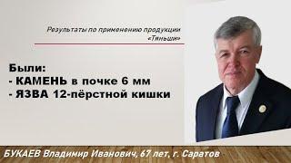 Были: камень в почке 6 мм и язва 12-перстной кишки. Отзыв по продукции Тяньши. Букаев Владимир, 67л.