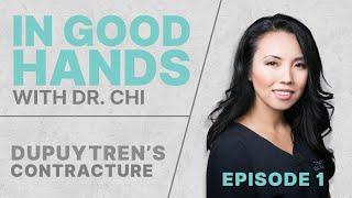 Dupuytren's Contracture EP.1 "In Good Hands With Dr. Chi"