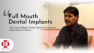 Full Mouth Dental Implants | Dental Treatment in 1 Day | Royal Implant