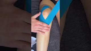 How to tape for knee pain/discomfort