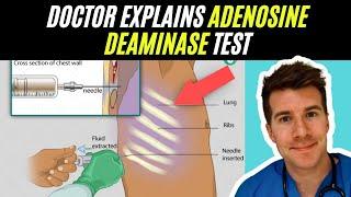 Doctor explains Adenosine Deaminase test | Tuberculosis (TB)