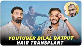 Youtuber Bilal Rajput Hair Transplant | Best Hair Transplant Clinic in india