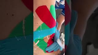 Chinesiologo Andrea Arrabito Applicazione Taping Spalla Fisioterapia F-Medical Group di Frosinone