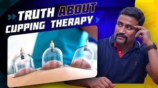 Truth about Hijama/Cupping Therapy !!