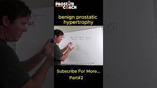 Everything you want to know about benign prostatic hypertrophy (BPH)