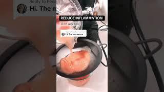 Comment recipe to get recipe in comment section