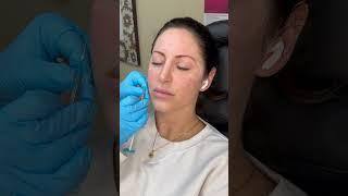 SkinVive For Crepey Skin