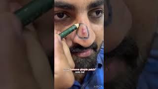 GET BLACKHEADS FREE WITH DAMN GOOD BY MRIDUL MADHOK!!