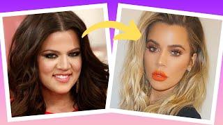 Khloe Kardashian's plastic surgery: the TRUTH | Opt into Beauty