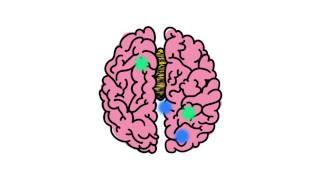 Understanding Disorders of the Corpus Callosum Animated Video (by NODCC)