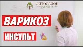 Варикоз вен нижних конечностей