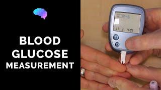 Blood Glucose Measurement | CBG | OSCE Guide | UKMLA | CPSA