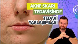 Skar Tedavisine Yaklaşım Nasıl Olmalı?