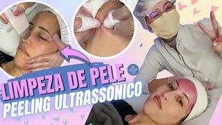 Limpeza de pele com peeling ultrassônico | Antes e Depois