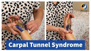 Carpal Tunnel Syndrome