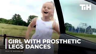 Girl With Prosthetic Legs Dances Alongside Moving Car