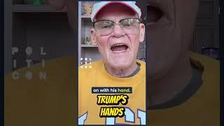 Trump's Hands
