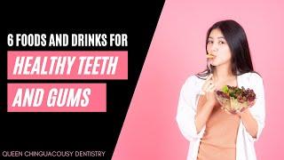 6 Foods and Drinks for Healthy Teeth and Gums | Queen Chinguacousy Dentistry