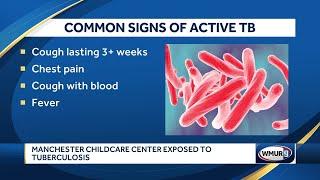 Children, staff exposed to tuberculosis at Manchester child care facility, DHHS says