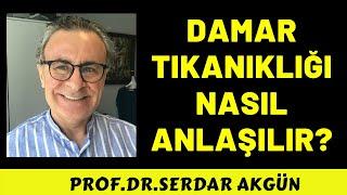 Damar tıkanıklığı nasıl anlaşılır? Riski nedir?Anjiyo şart mı? Serdar Akgün, Sağlık Videoları..