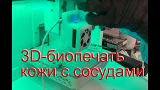 Создана технология 3D-биопечати кожи с сосудами