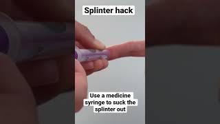 How to remove a splinter #shorts #splinter #splinterhack