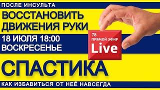 ВОССТАНОВИТЬ ДВИЖЕНИЯ РУКИ ПОСЛЕ ИНСУЛЬТА. СПАСТИКА, КАК УБРАТЬ НАВСЕГДА.