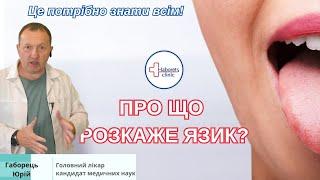 Про що розкаже язик? Це потрібно знати кожному!