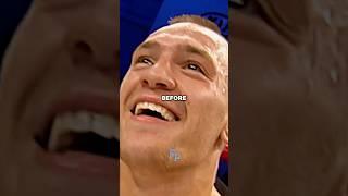 UFC Fighters Before And After...