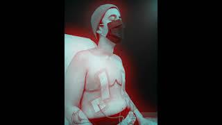Top Surgery Week 2