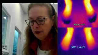 How This Patient Saw a 50% Increase in Sensory in 3 Months!