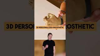 3D Personalized Prosthetic