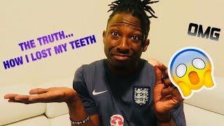 THE TRUTH (HOW I LOST MY TEETH)