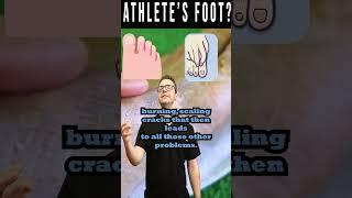 Athlete's Foot Fungus: The Itchy, Scaly Truth!