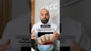Почему зубы шатаются после профессиональной чистки? #зубы #спб #стоматология #стоматолог #топ#топ