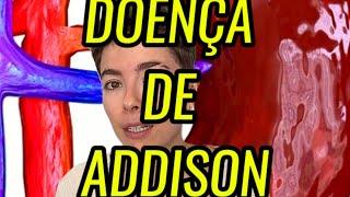 O que é a Doença de Addison?